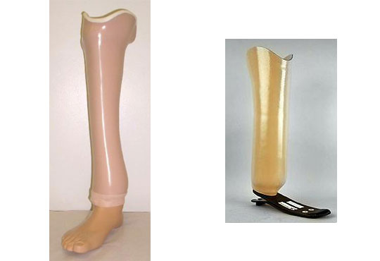 Symes Prostheses