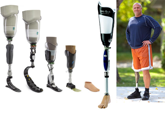 Transfemoral Prostheses